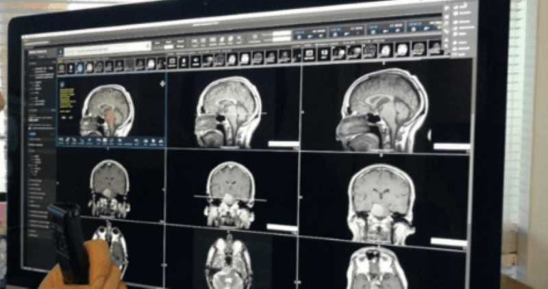 Photo shows a large computer screen with patient care diagnostic data imagery 
